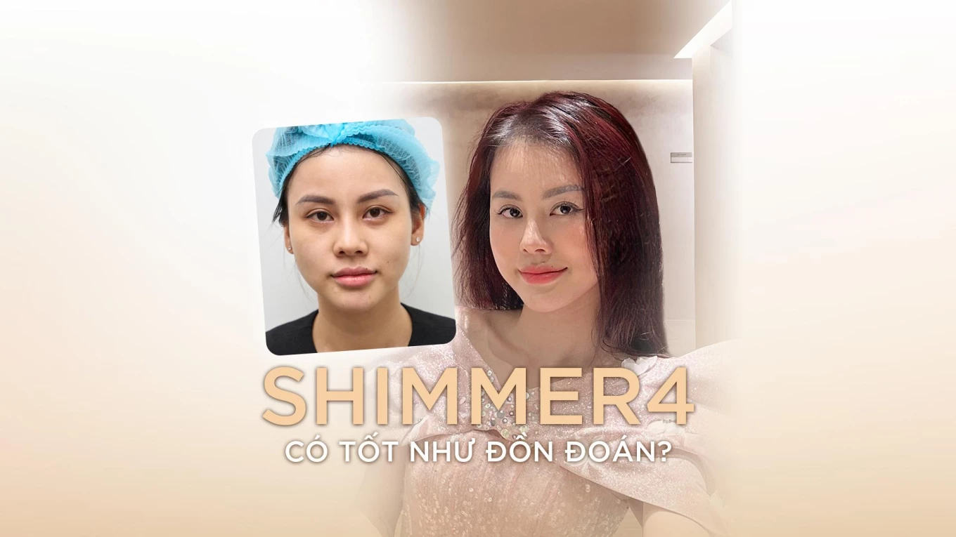 Shimmer4 có tốt như đồn đoán?